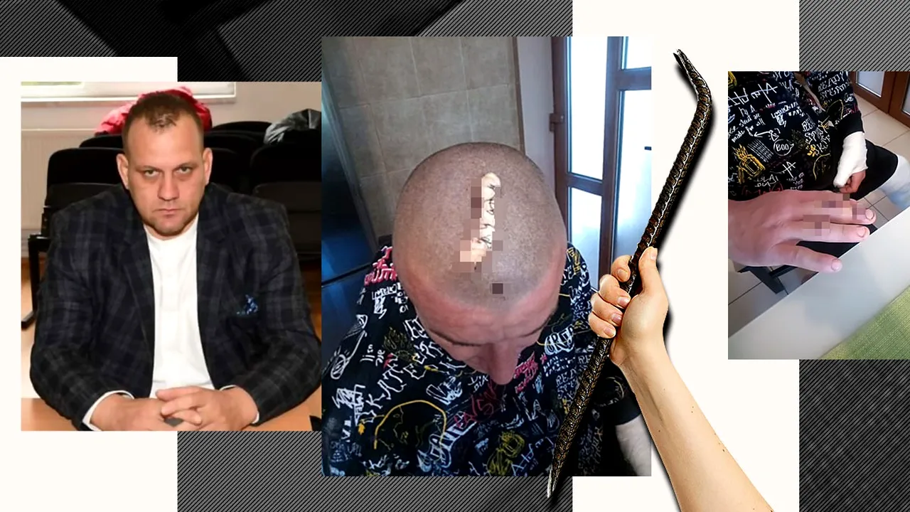 Un bărbat a fost cusut și băgat în ghips, după ce a fost BĂTUT cu ranga de un politician din Dâmbovița