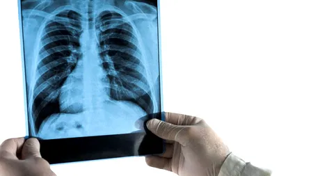 Focar misterios de pneumonie într-un oraș din Argentina. A fost identificată bacteria care a ucis șase oameni într-o săptămână