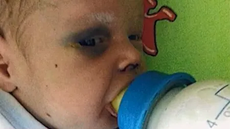 Caz șocant. Un nou născut se luptă să trăiască după ce mama lui l-a bătut și a plecat la o întâlnire