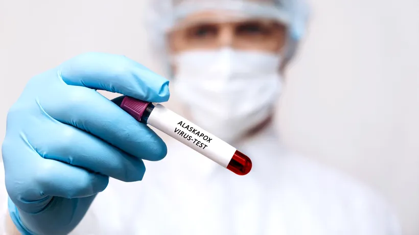 Un bărbat a murit după ce s-a infectat cu un nou VIRUS, descoperit recent în Alaska. Specialiștii spun că este înrudit cu cel care provoacă variola