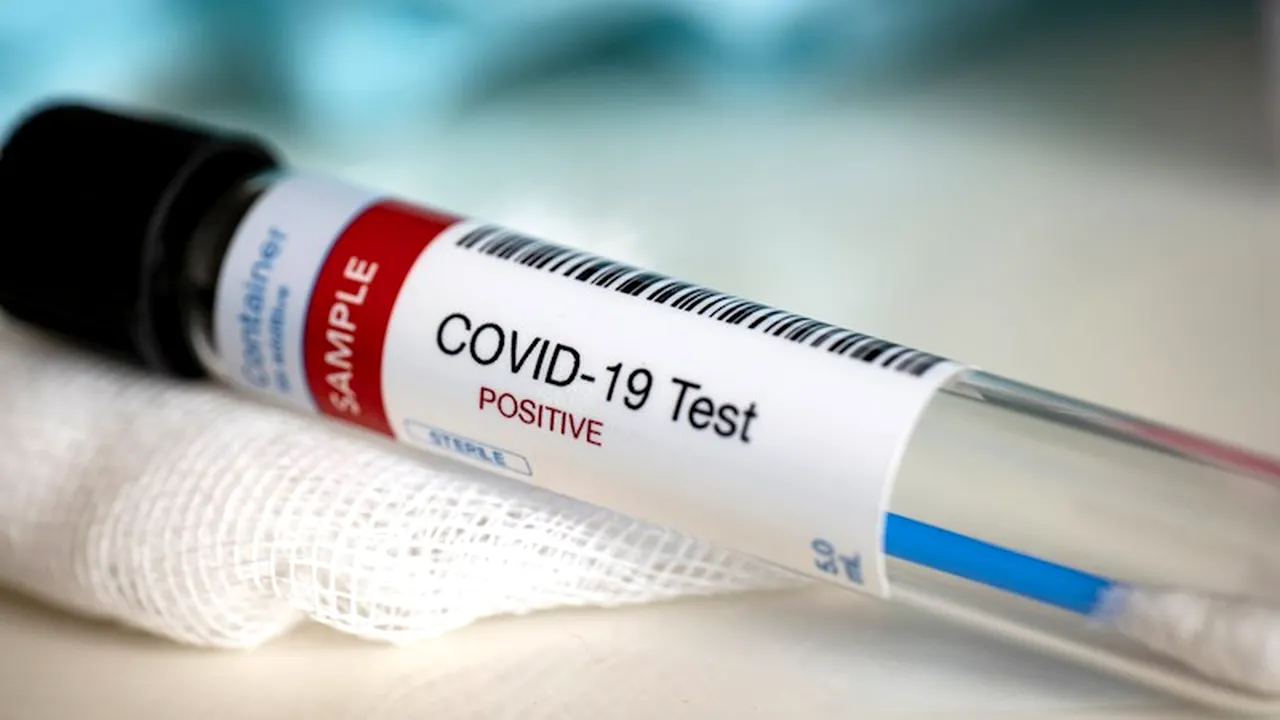 INSP a actualizat algoritmul de testare pentru COVID-19. Care este strategia și cine are prioritate