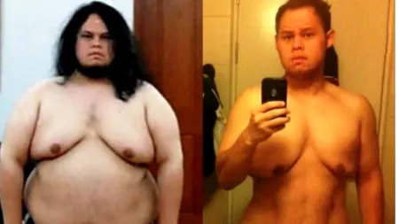 A reușit să slăbească, dar acum arată mult mai rău decât înainte 