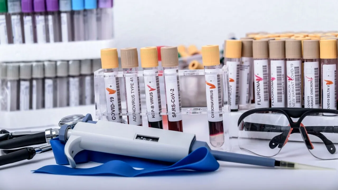 OMS: Ancheta privind originea Covid-19, fără CONCLUZII, din cauza lipsei de COOPERARE a Chinei și a mai multor agenții de informații