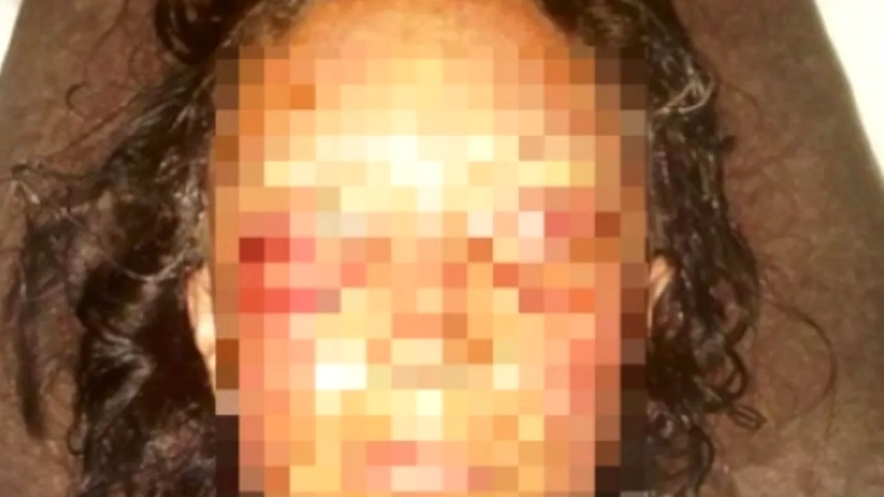 Ce a pățit o femeie după ce a folosit o cremă antirid