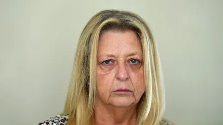 Caz medical neobișnuit: Îmi putrezesc unghiile și nu știu de ce. E oribil! - FOTO