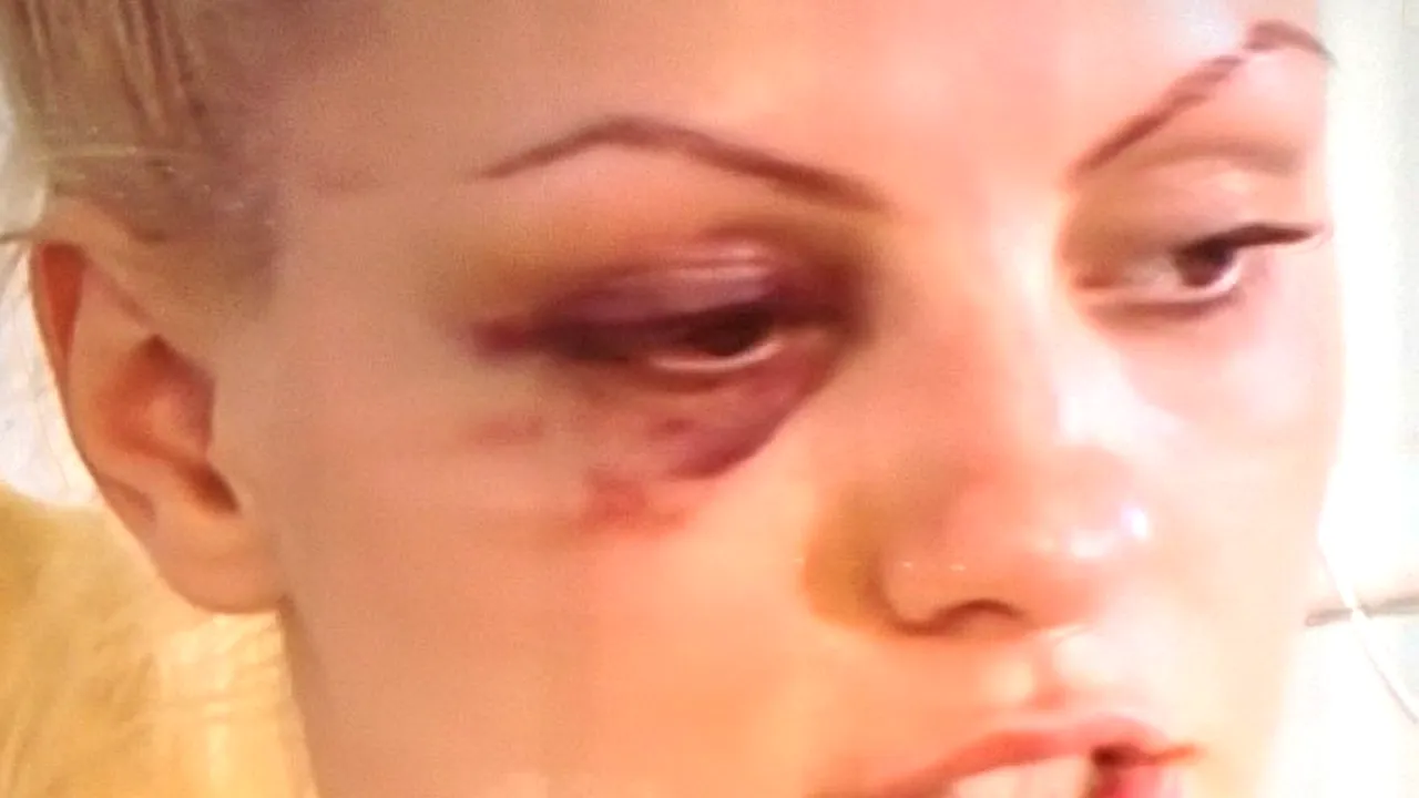 Alexandra Stan a vrut să se sinucidă: „Am vrut să-mi tai venele