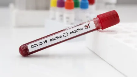 „Afacere” în pandemie: Vânzarea de certificate false cu rezultate negative pentru COVID prin intermediul Facebookului