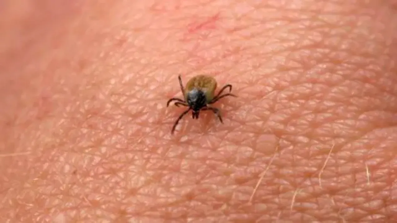 Ce trebuie să faci dacă ești mușcat de o căpușă. Când trebuie să ajungi rapid la SPITAL