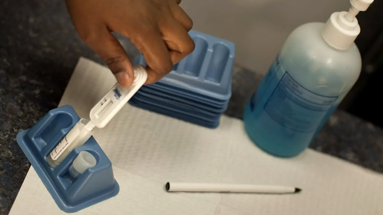 Teste HIV gratuite în farmaciile americane