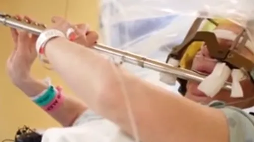 Imagini încredibile din sala de operație. O femeie a cântat la flaut în timp ce era operată pe creier. VIDEO