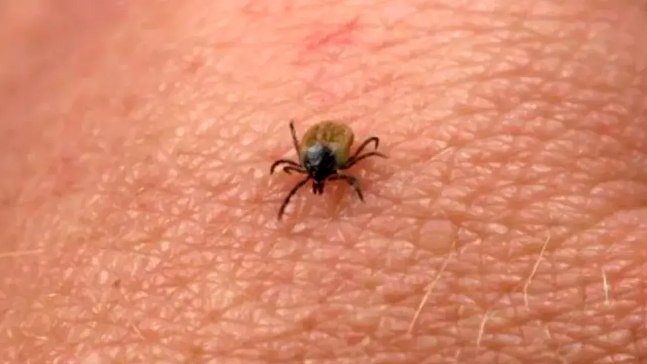 Cum scapi de CĂPUȘE dacă stai la curte. Acest truc va ține la distanță insectele