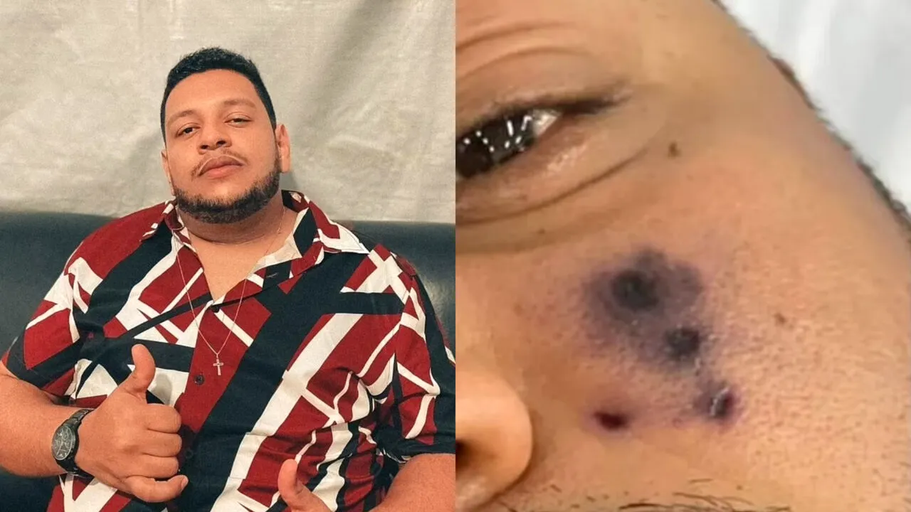 Condamnat la moarte! Sfârșitul BIZAR al unui cunoscut artist. Seara a fost mușcat, iar dimineața s-a trezit cu o stare de rău