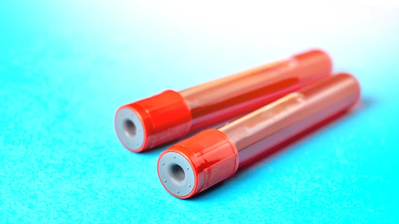 Primul caz de mpox din Asia, confirmat în Tailanda