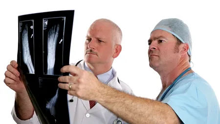 STUDIU. Riscurile la care se expun fumătorii în caz de fracturi