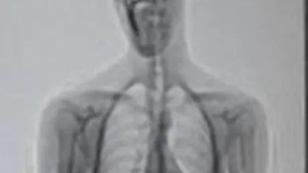 FOTO. Ce au descoperit polițiștii în stomacul unui deținut