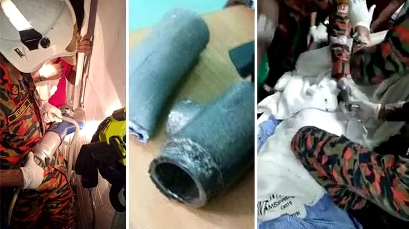 Un adolescent a chemat descarcerarea în ajutor, după ce și-a introdus bărbăția într-o țeavă metalică - VIDEO