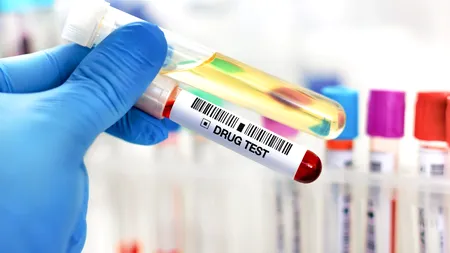 Înalta Curte a decis că sunt necesare EXPERTIZE pentru a stabili dacă substanțele psihoactive găsite în organsimul unui șofer îl afectează la condus