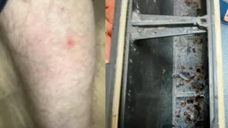 Poliţişti muşcaţi de ploşniţe în sediile Poliţiei Capitalei: zece persoane au ajuns la Urgență. Măsurile cerute de sindicatul Europol