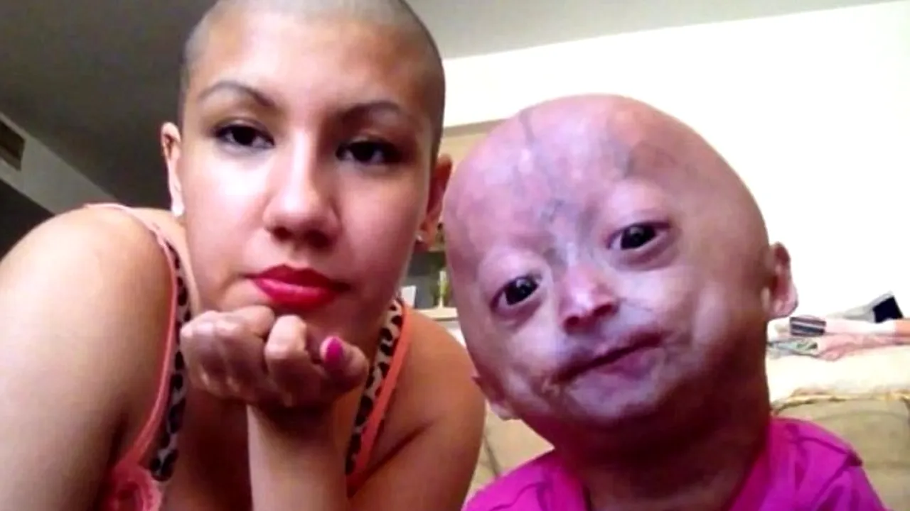 Fata de șase ani blocată într-un corp de bătrână care a cucerit Internetul