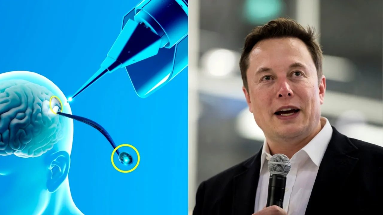 O femeie, paralizată complet, a reușit să-și SCRIE numele cu ajutorul tehnologiei Neuralink. Elon Musk: 