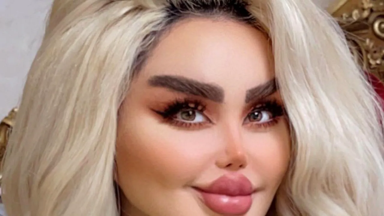 Cum arată Barbie din Irak. Prezentatoarea a făcut 43 de operații estetice pentru a arăta ca o păpușă