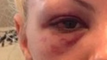 Alexandra Stan bătută. Tatăl artistei: 