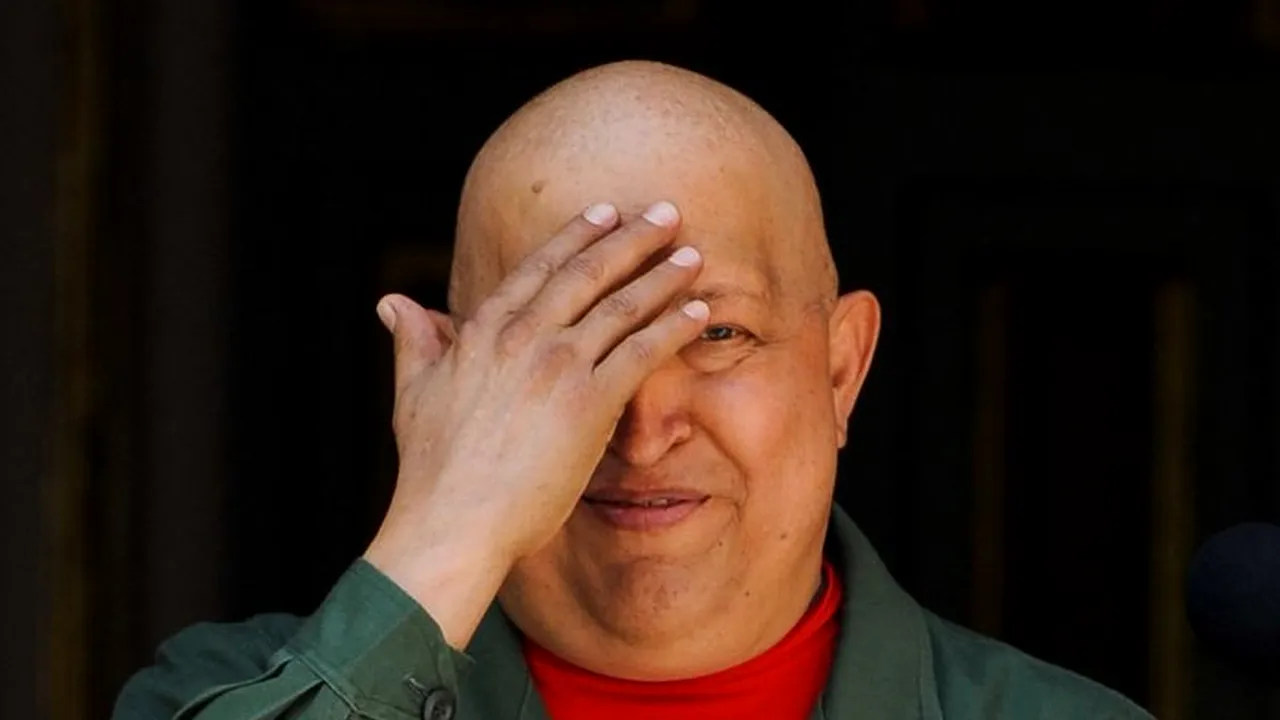 Hugo Chavez a suferit o 