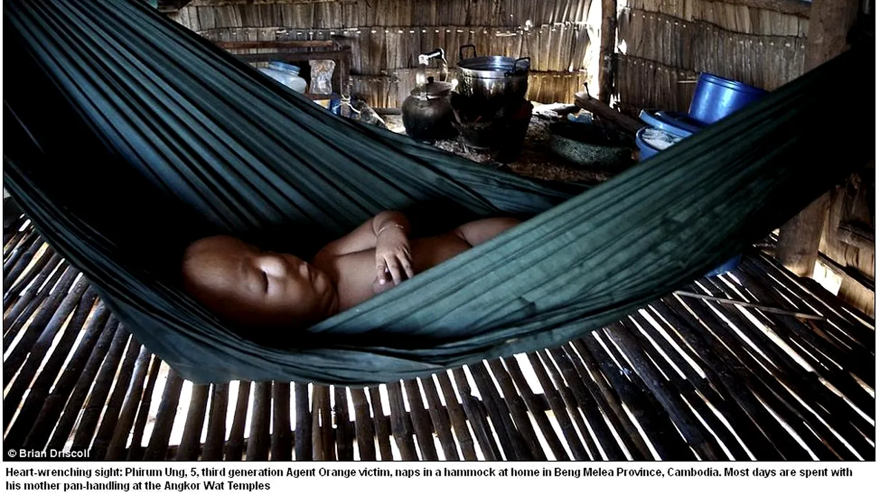 FOTO. Milioane de vietnamezi resimt încă efectele atacurilor chimice din timpul războiului. Cum arată copiii atinși de 