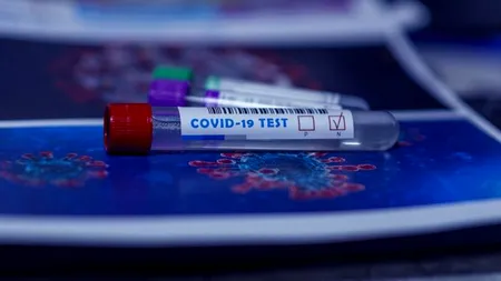 Un studiu „desființează” testele antigen: Jumătate din cele efectuate dau rezultate fals negative! „RT PCR rămân testele gold standard la nivel mondial pentru diagnosticarea COVID-19”
