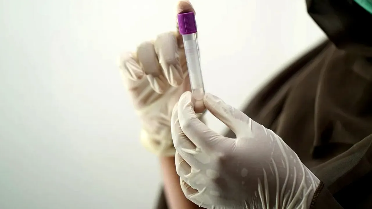 Cum este afectat creierul după Covid. Ce spun studiile