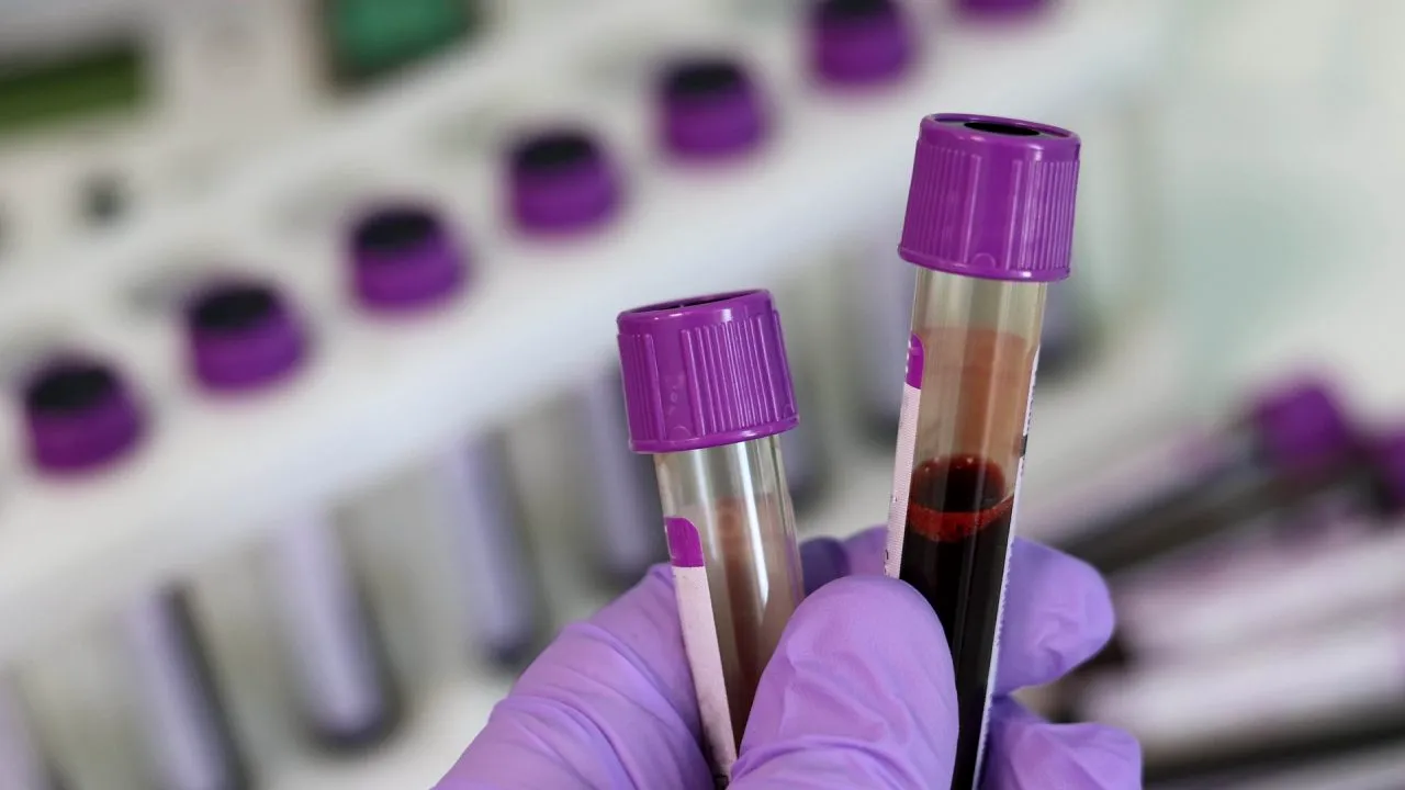 OMS: Risc biologic URIAȘ după ce combatanții au ocupat un laborator din Sudan, în care sunt ținute mostre de virusuri de holeră, pojar și poliomielită