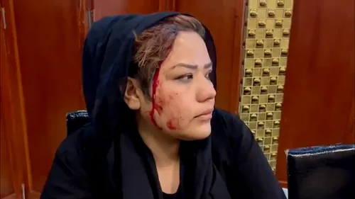 ”Pacea talibanilor”. Gaze lacrimogene și bastoane, folosite împotriva protestatarelor care au cerut respectarea drepturilor femeilor