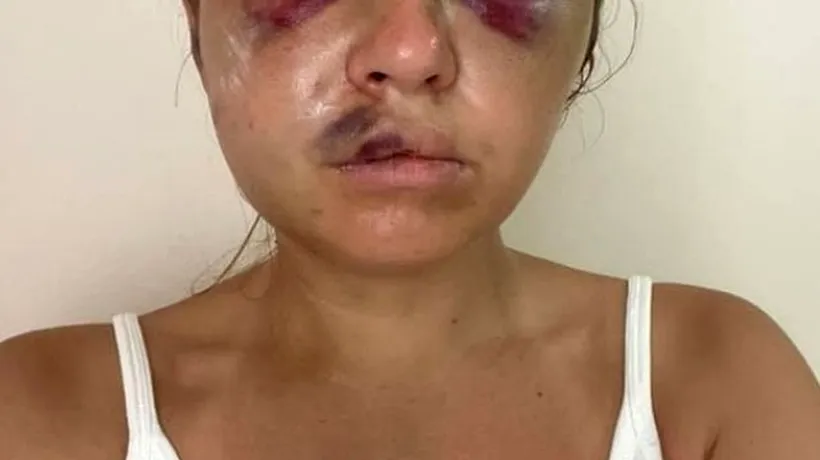Vedetă TV, mutilată de un bărbat care a vrut să o violeze în fața fiului ei de șase ani. Cum a scăpat tânăra de 28 de ani din mâinile brutei