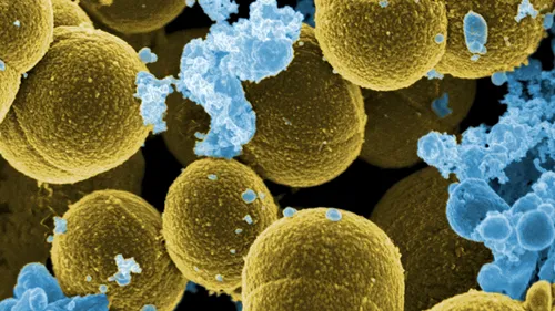 10 milioane de vieți s-ar putea pierde în lupta cu superbacteriile. Cât de departe a ajuns știința în războiul împotriva lor