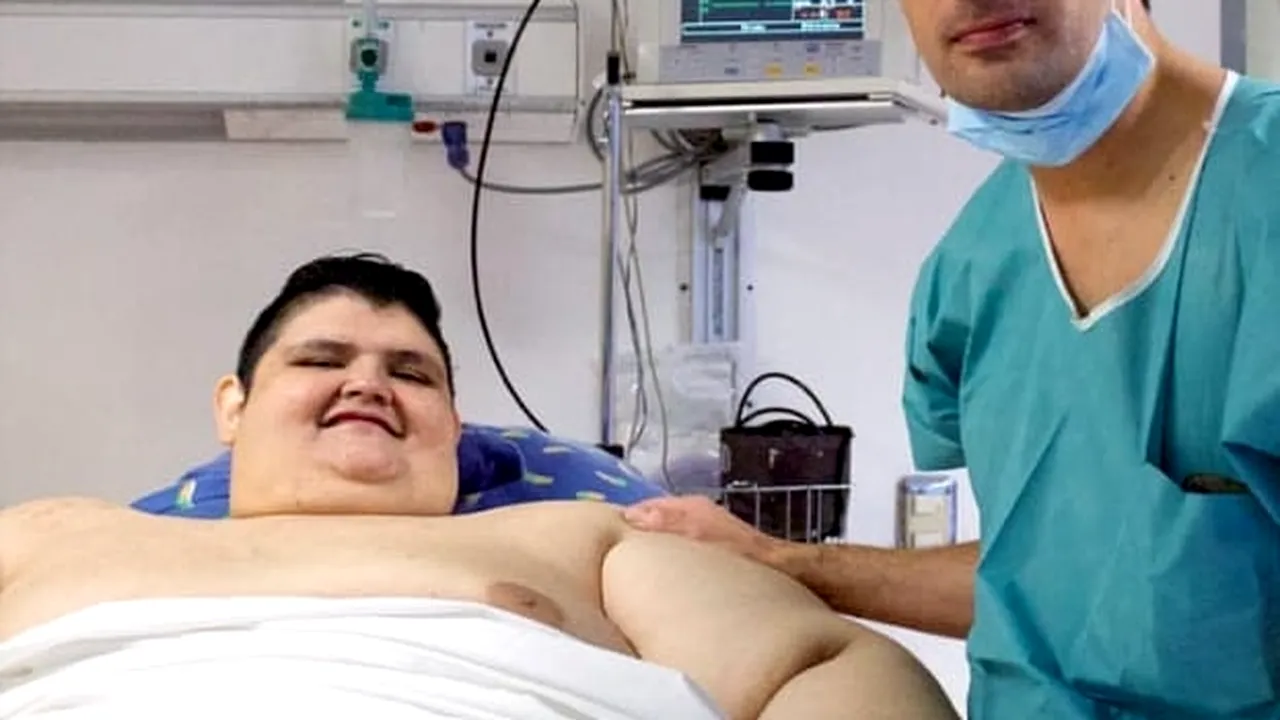INCREDIBIL. Cel mai gras om din lume a reușit să slăbească 330 de kilograme. Cât cântărește acum și cum arată