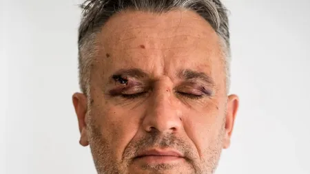 Au fost reținuți patru dintre indivizii care au bătut cu bestialitate doi jurnaliști și un activist de mediu