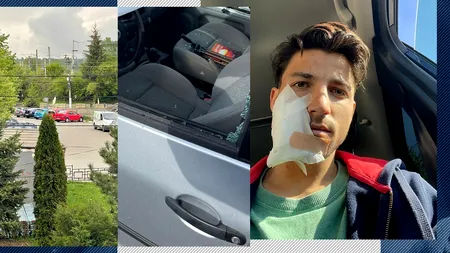Un tânăr din Câmpina, MUTILAT în parcare. Agresorul i-a spart geamul mașinii cu o sticlă de bere și a fugit. ”Am văzut cioburi și cum sărea sângele”