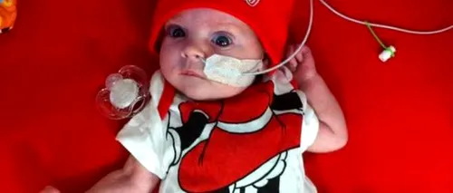 Povestea impresionantă a acestui bebeluș. Medicii nu-i dădeau nicio șansă de supraviețuire