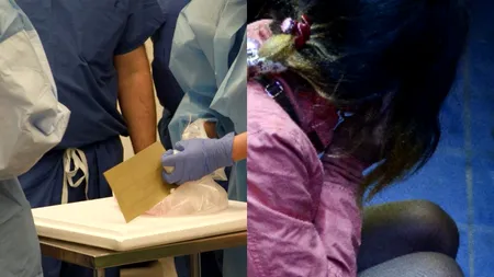 Un chirurg este acuzat că a abuzat sexual sute de minori. Ce spune avocatul presupusului monstru: „Sunt doar fantezii din mintea lui...