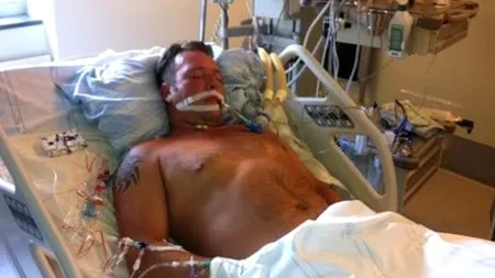 Caz incredibil în Suedia. Nu putea să vorbească sau să se miște, dar a auzit doctorii vorbind despre cum îi vor preleva organele