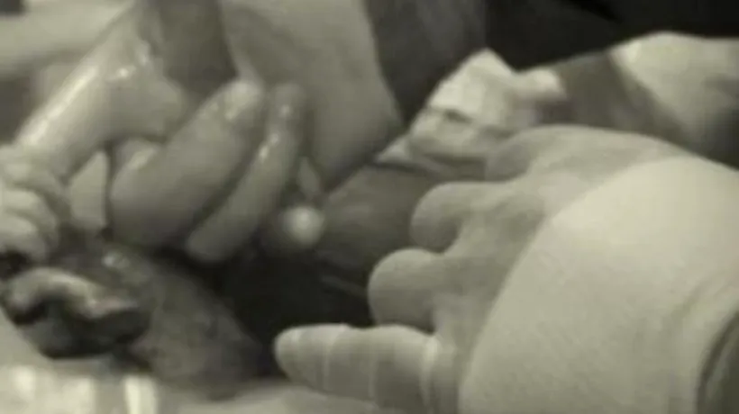 Primul contact cu lumea. Un nou-născut ia medicul de deget înainte de a fi scos din pântecele mamei