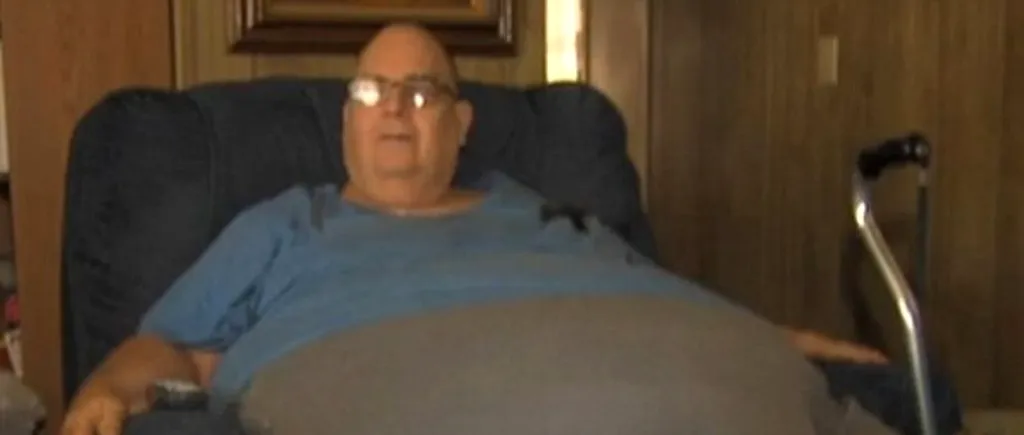 Un bărbat are o tumoră gigantică, de 90 de kilograme, pe abdomen