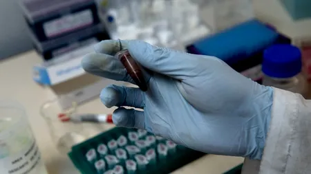 România, printre primele țări din Europa în privința incidenței tuberculozei: 15.000 de cazuri anual