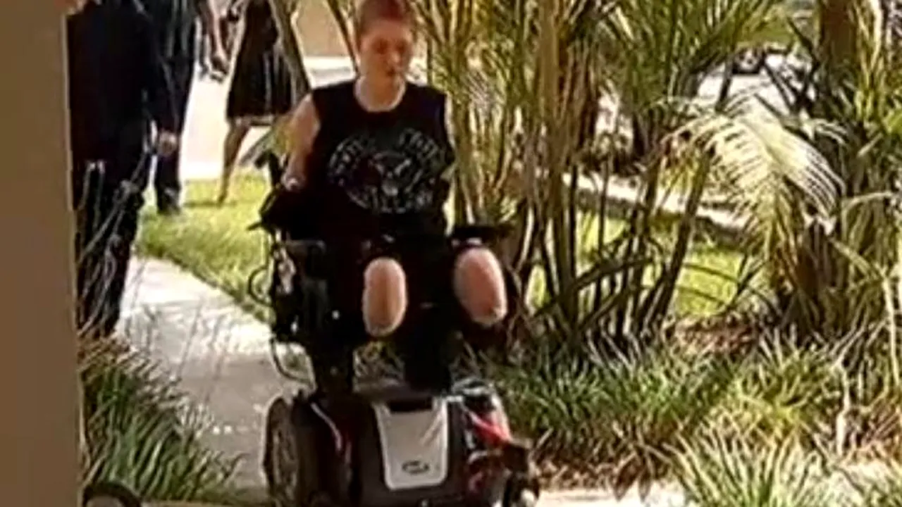 Povestea tinerei care a învins boala după 20 de operații în care i-au fost amputate mâinile și picioarele. VIDEO