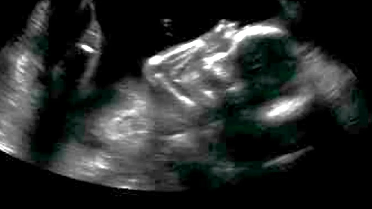 O cercetătoare șochează: HIBRIDUL UMAN născut din împreunarea unei femei cu o specie necunoscută