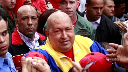 Hugo Chavez este operat 