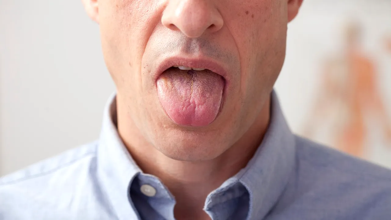 Ce înseamnă dacă LIMBA este prea roșie. Medicii explică și avertizează, în același timp