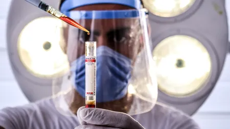 Bilanț Covid în România, 02 august 2021: 137 de noi infectări SARS-CoV-2 în ultimele 24 de ore