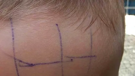 FOTOGRAFIE incredibilă de la o grădiniță din Gorj, unde un copil de 4 ani a fost scris cu pixul pe față pentru a fi pedepsit: 