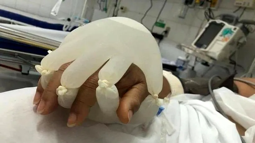 „Mâna lui Dumnezeu”. Asistenții medicali din Brazilia au venit cu o idee inovatoare pentru pacienții izolați la ATI. Fotografia a devenit virală